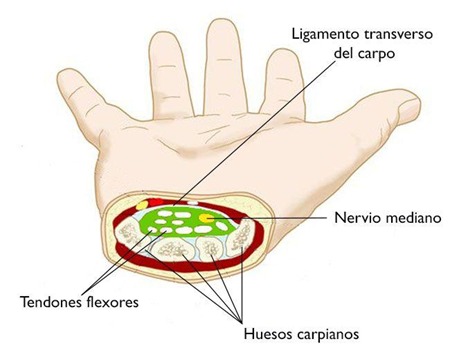 Túnel carpiano